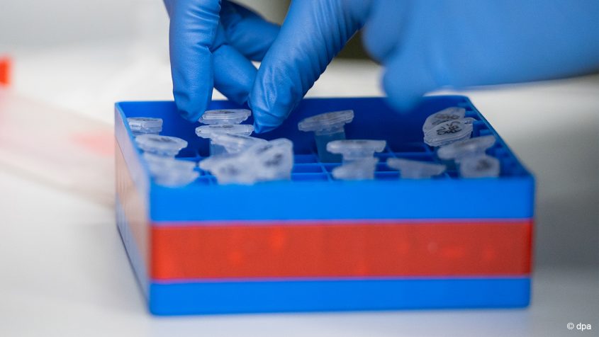 Laborarbeit zum Coronavirus. © dpa / Christophe Gateau